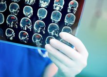 استفاده از یک نانوذره برای تصویربرداری با نشر پوزیترون