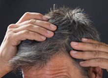 عارضه‌های زیاده روی در رنگ کردن مو