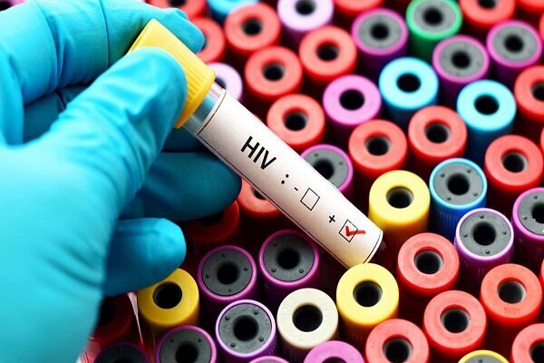 روند پیری در زنان مبتلا به HIV سریع تر اتفاق می‌افتد